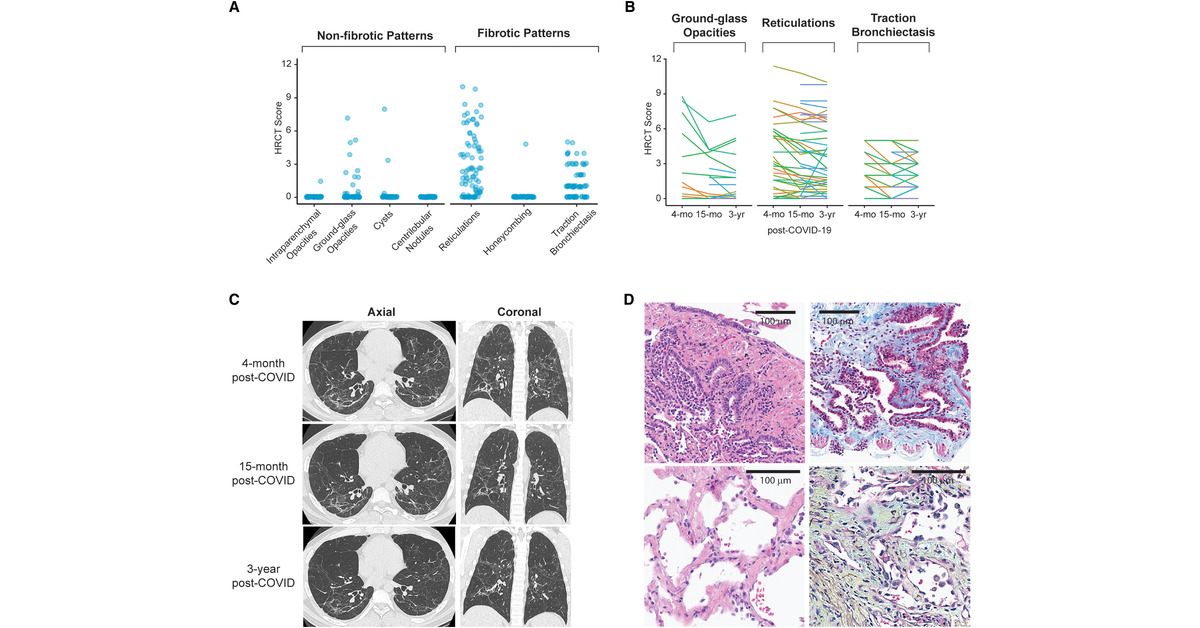 Annals of the ATS tweet media