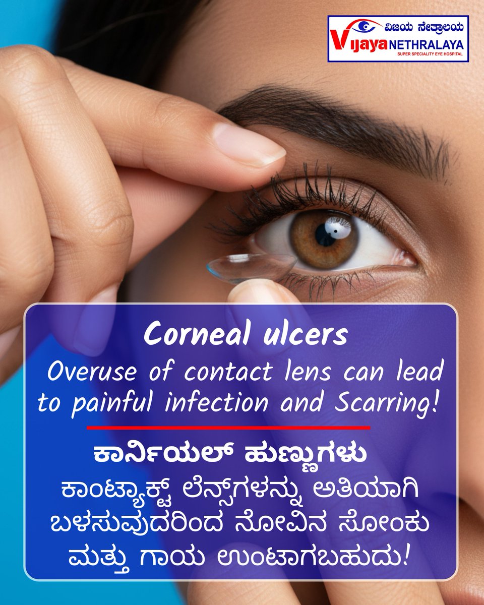VijayaEyecare's tweet image. 👁️💭 Love your contact lenses but feeling irritation lately?
Your eyes might be saying, “I need a break!” 😣
✨ Let our experts check if lenses still suit your eyes

👉 DM us or visit vijayanethralaya.com
📞 9880466486

#EyeCare #VijayaNethralaya #ContactLensTips #HealthyEye