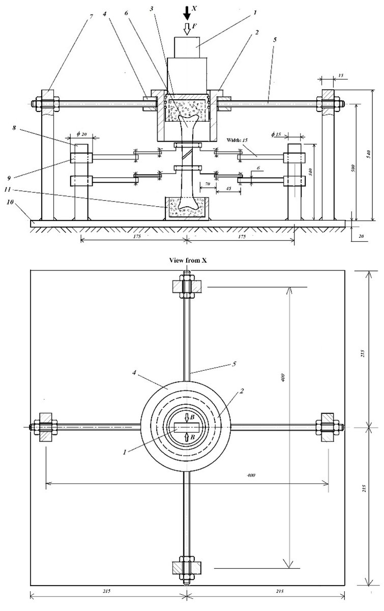 Prosthesis_MDPI's tweet image. 🦴🔍📊 A concise review + novel approaches for experimental analysis of fractured human bones—delivering rigorous insights for orthopedic &amp;amp; trauma research. 

doi.org/10.3390/prosth… 

#FracturedBoneAnalysis #OrthopedicResearch #TraumaBiomechanics
