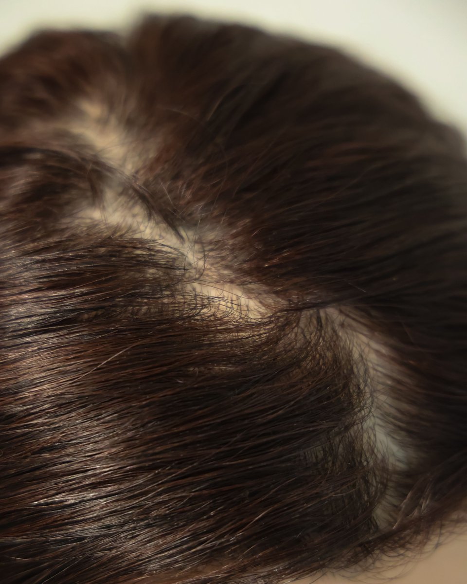 「不自然なヘアライン」に、もうさようなら👋

マスクによくある悩みを、私たちは技術で解決しました😆「ヘアリアルエディション」は、核心的な課題と向き合い、カメラはもちろん、至近距離で見てもわからないほどの自然なヘアラインを実現。

こんなシーンで：
・映画やドラマの制作現場