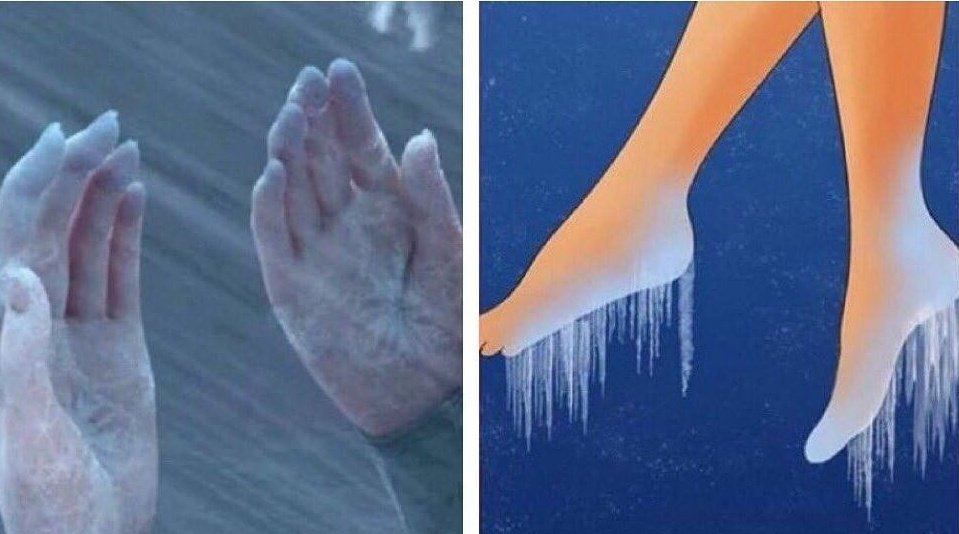 YoStoConTarabas's tweet image. le mie mani e i miei piedi da novembre a giugno