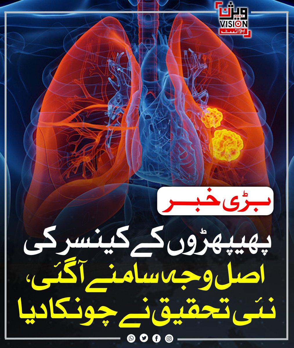 VisionPointPK's tweet image. ایم ڈی اینڈرسن کینسر سینٹر کے محققین نے پھیپھڑوں کے صحت مند خلیوں سے کینسر زدہ خلیوں تک کے سفر کا نقشہ تیار کر کے پھیپھڑوں کے کینسر کی جڑ تک پہنچنے میں بڑی پیش رفت کی ہے۔
#LungCancerResearch #MedicalBreakthrough #CancerTreatment