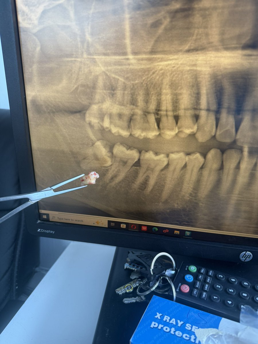 They woke up and decided to be less wise 
Today 🤭. 
Left behind some wisdom 🦷🫠