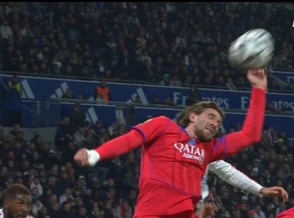 ActuFoot_'s tweet image. 🚨 Les mots du camion VAR sur la main de Zabarnyi 🇺🇦 face à l’OL :

« 𝗢𝗛 𝗜𝗟 𝗔 𝗗𝗘 𝗟𝗔 𝗖𝗛𝗔𝗡𝗖𝗘. […] 𝗜𝗟 𝗡𝗘 𝗦𝗘𝗠𝗕𝗟𝗘 𝗣𝗔𝗦 𝗧𝗢𝗨𝗖𝗛𝗘𝗥 𝗟𝗘 𝗕𝗔𝗟𝗟𝗢𝗡… 𝗜𝗟 𝗡𝗘 𝗟𝗔 𝗧𝗢𝗨𝗖𝗛𝗘 𝗣𝗔𝗦. 

𝗖̧𝗔 𝗡𝗘 𝗕𝗢𝗨𝗚𝗘 𝗣𝗔𝗦 𝗟𝗔 𝗧𝗥𝗔𝗝𝗘𝗖𝗧𝗢𝗜𝗥𝗘. ❌…