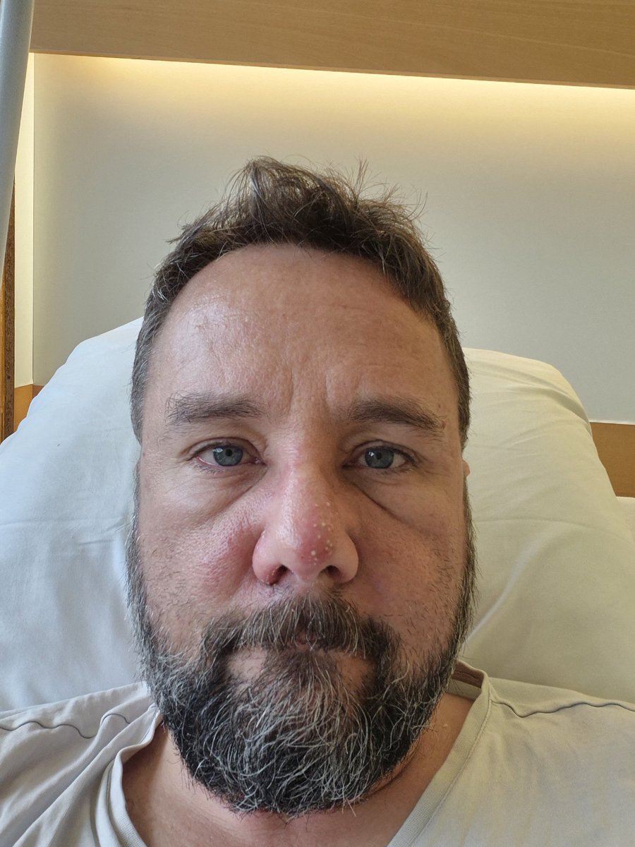 Moins rouge mais toujours bien enflé, et le côté "fleuri" du nez je m'en serai bien passé. Vivement que les antibios dégagent tout ça, mais la sortie n'est pas prévue pour aujourd'hui