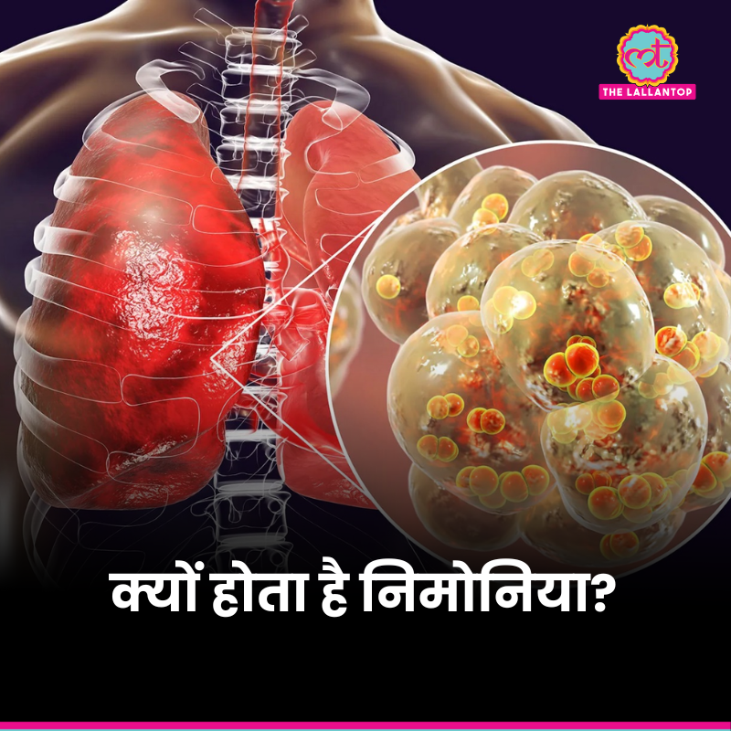 TheLallantop's tweet image. आज है वर्ल्ड निमोनिया डे. जानिए #Pneumonia क्यों होता है और इससे कैसे बचें?

youtube.com/watch?v=E5B93-…

#WorldPneumoniaDay