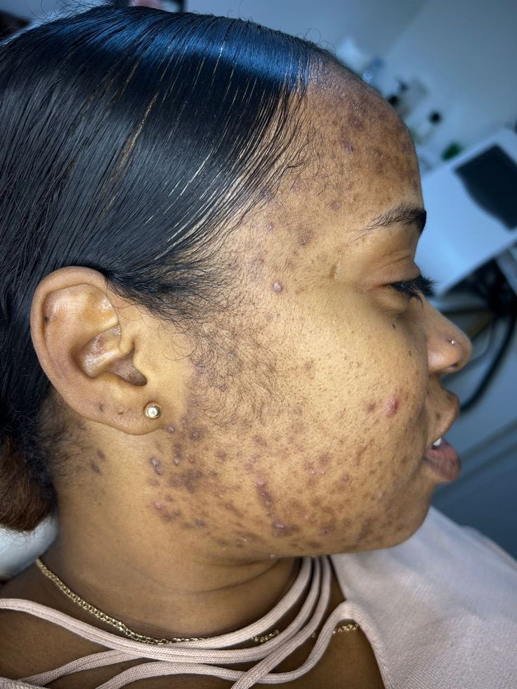 How to get rid of this please? It is urgent