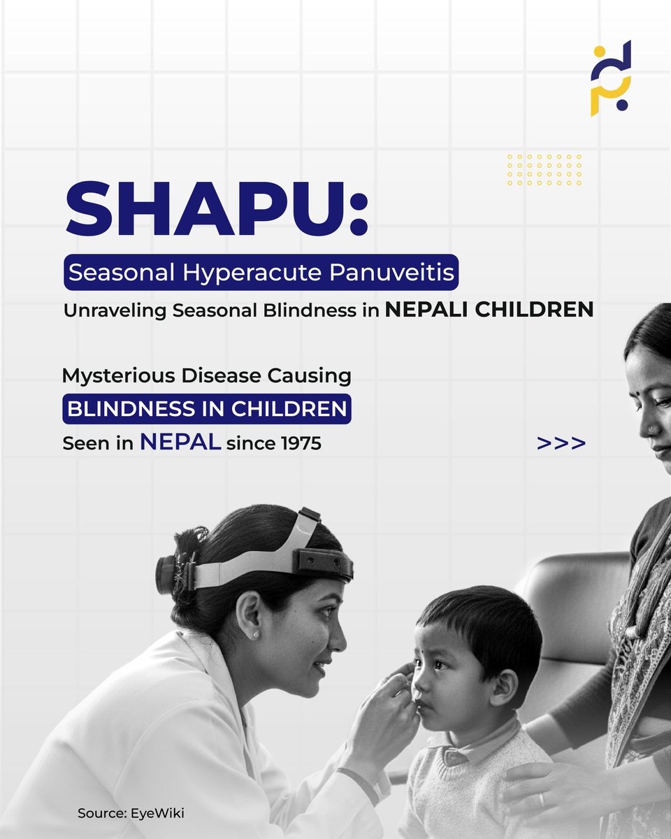 DevPulseInfo's tweet image. SHAPU is a rare eye disease in Nepali children, causing rapid vision loss.

Linked to moth contact, it can lead to blindness within a week.

Seek care immediately for red eye, white pupil, or sudden vision loss.

#DevPulse #SHAPU #NepalHealth #EyeHealth #ChildBlindness