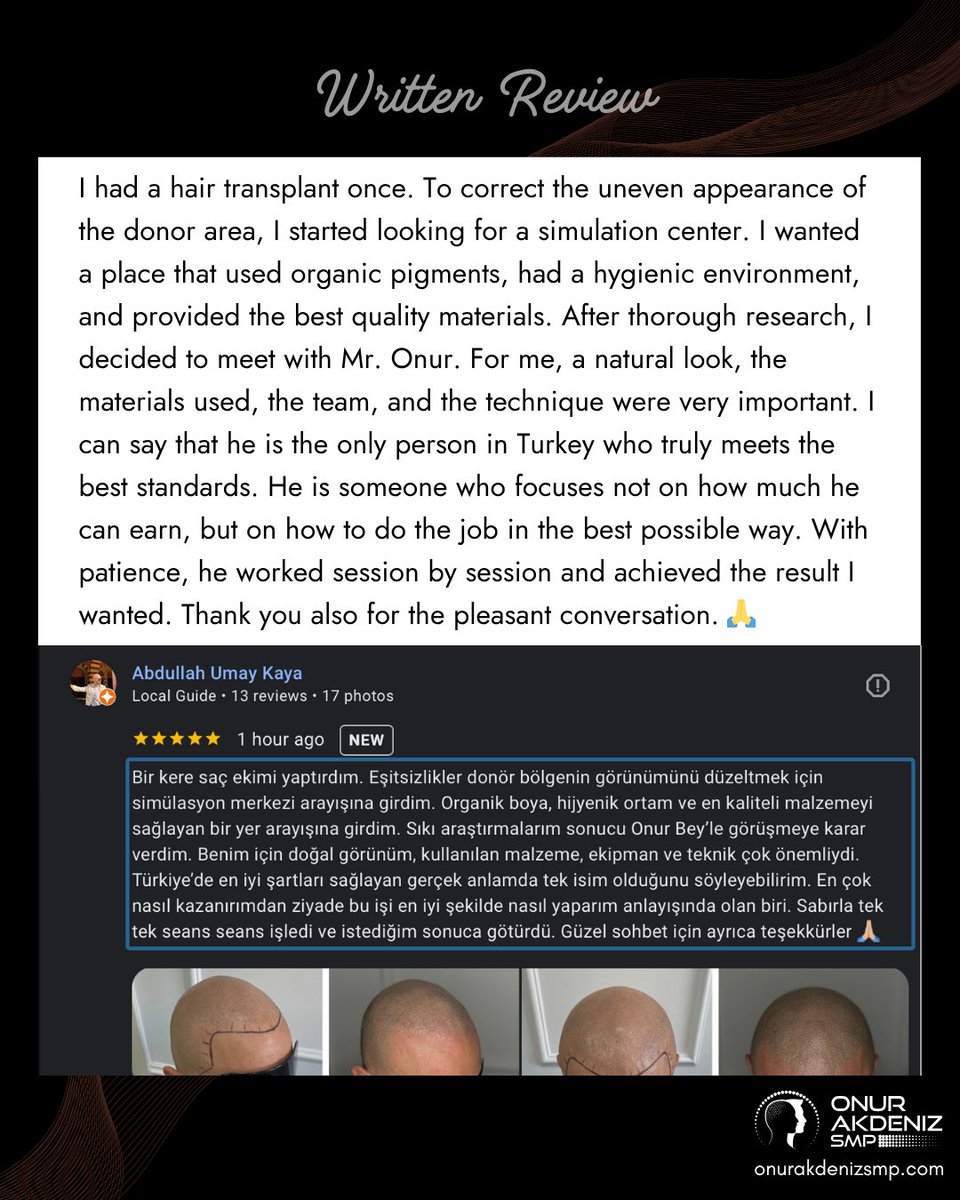 onurakdenizsmp's tweet image. Client words that make the journey worthwhile. 💬
Each transformation is built on trust, precision, and dedication.
Proud to be recognized not only for results, but for the standards and values that define my work. 🙏

#smp #micropigmentation #hairtattoo #saçsimülasyonu…