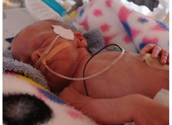 My water broke at 26 weeks with our first child; after two weeks of bedrest in the hospital, she was born at 28 weeks weighing just about 2 1/2 pounds. She spent 9 weeks in the NICU, where I would sit every day with her, watching her chest rise and fall. Add in the other very