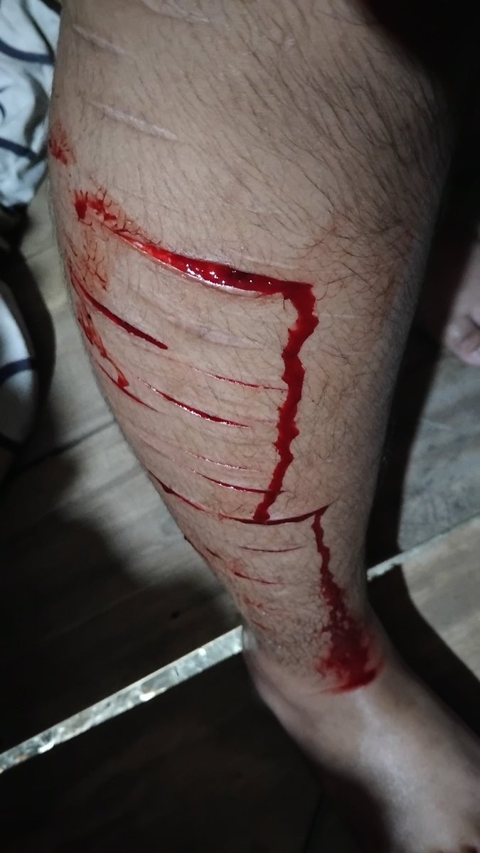 Intovert_09's tweet photo. #shtwt I tried it on my legs and a lot of it came out. https://t.co/l6Bbr8Sqpo
