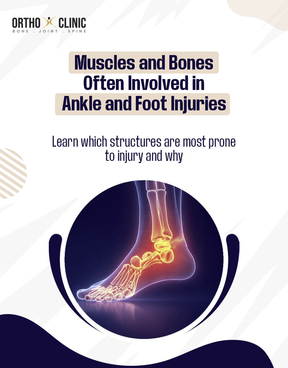 OrthoXClinic's tweet image. Ankle &amp;amp; Foot Injuries: Know Your Muscles &amp;amp; Bones!
Tip: Strengthening, proper footwear, and stretching go a long way in keeping your feet and ankles healthy!

#FootHealth #AnkleInjury #MuscleCare #Orthopedics #InjuryPrevention #Physiotherapy #HealthyFeet #SportsInjury #Anatomy