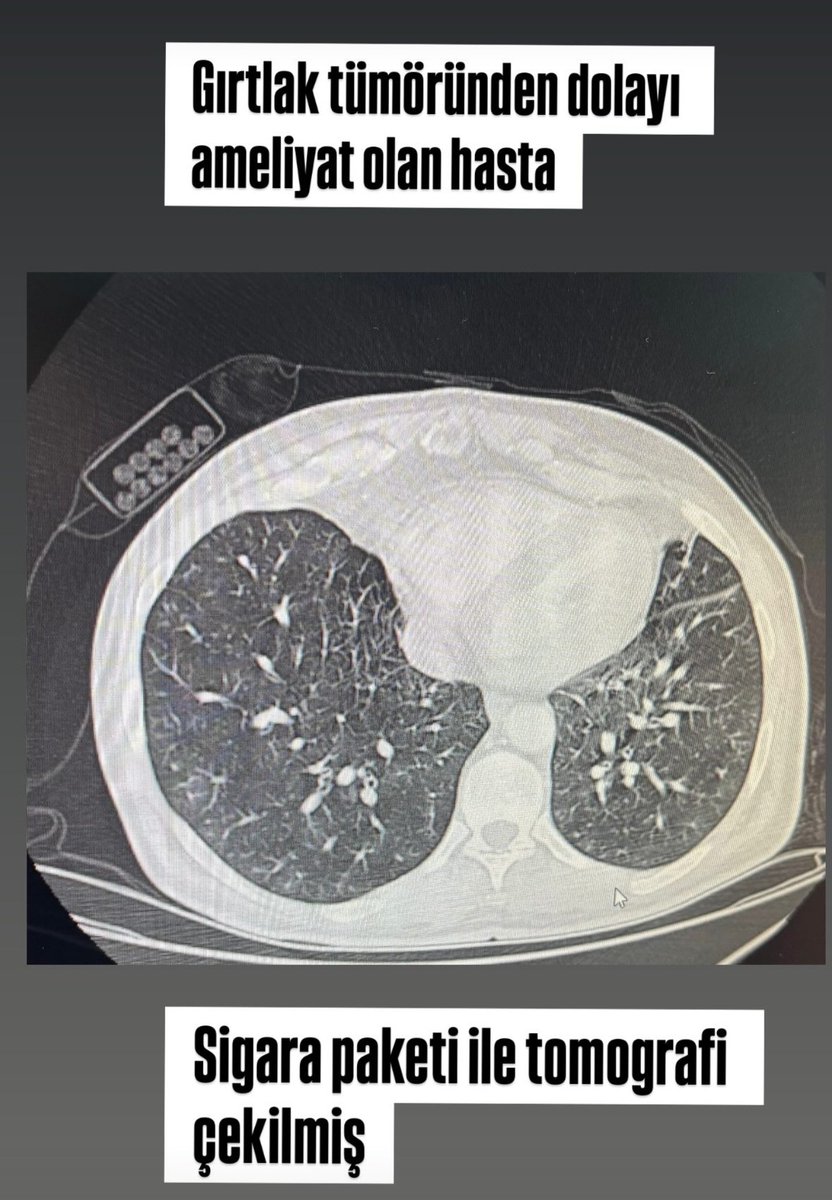 Bizim bağımlılık seviyesi
