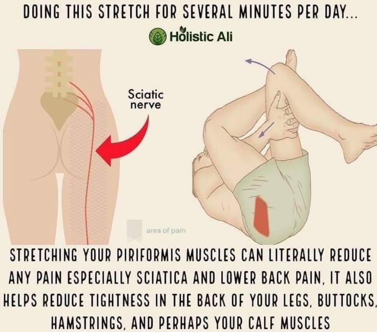 Do this every day to reduce sciatica and lower back pain.