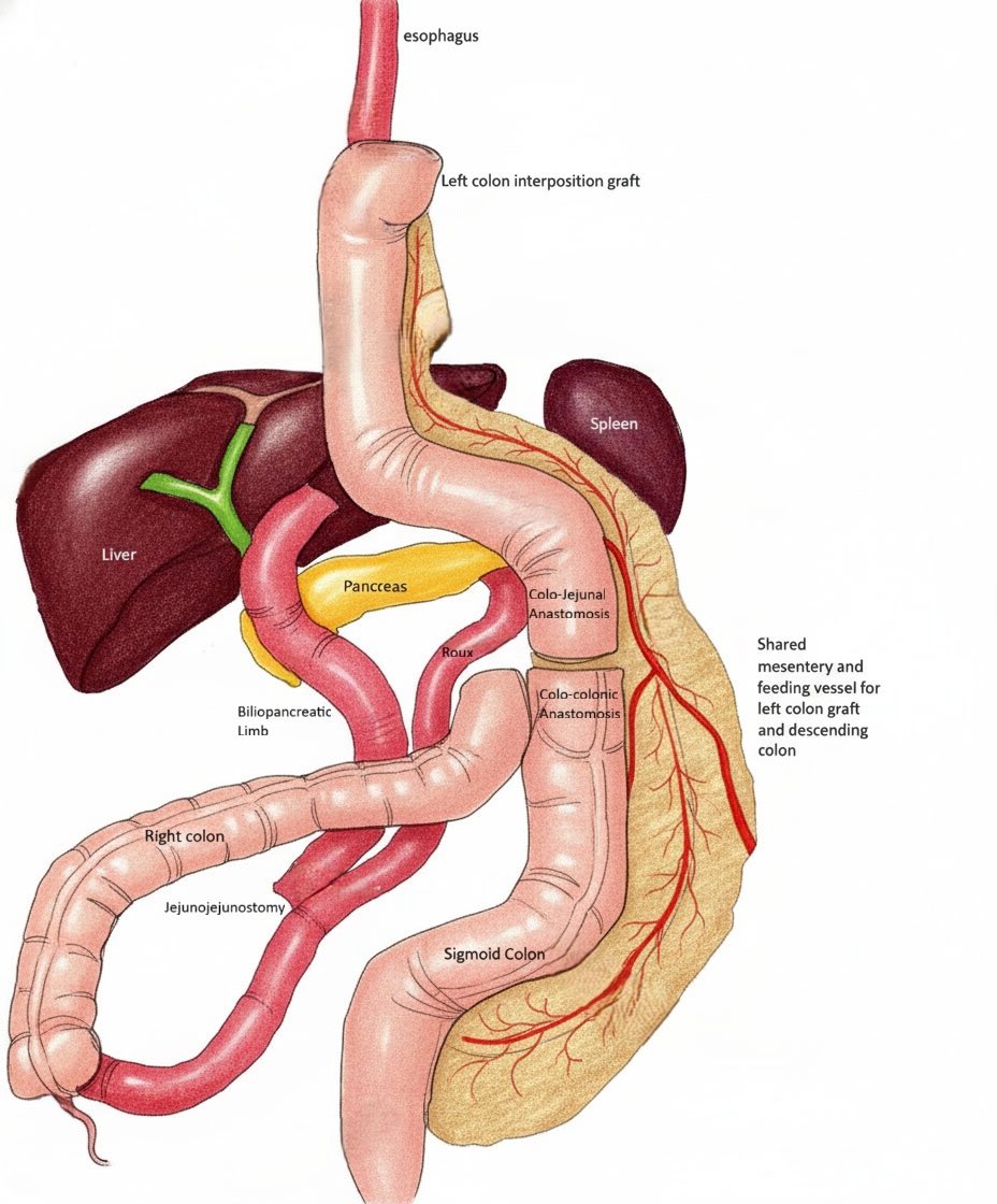 Ziad Awad, MD, FACS tweet media