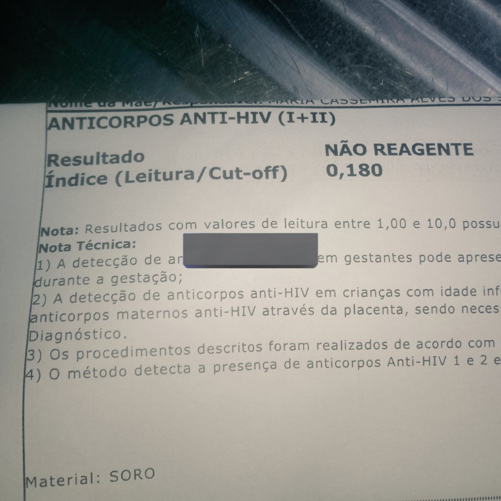 Graças Deus 🙌🏾 tudo em ordem,faço meus check UP anual já aproveito 😉