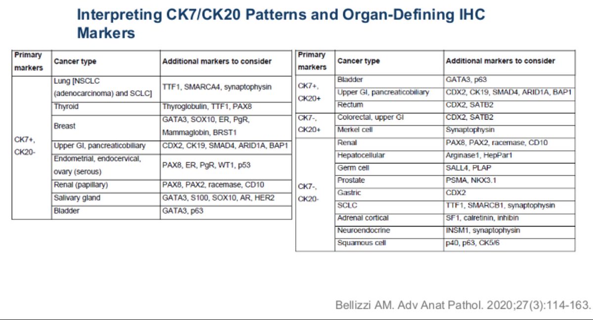 Cancer of Unknown primary thankfully is not very common but this still ends up being very challenging! IHC patterns that can help guide us the origin (slide by <a href="/OncoThor/">Thor Halfdanarson</a> and <a href="/hfuentesbayne/">Harry Fuentes MD MSc</a>) during CUP discussion!

#OncTwitter #MedTwitter <a href="/OncoAlert/">OncoAlert</a> <a href="/OncUpdates/">OncUpdates</a>