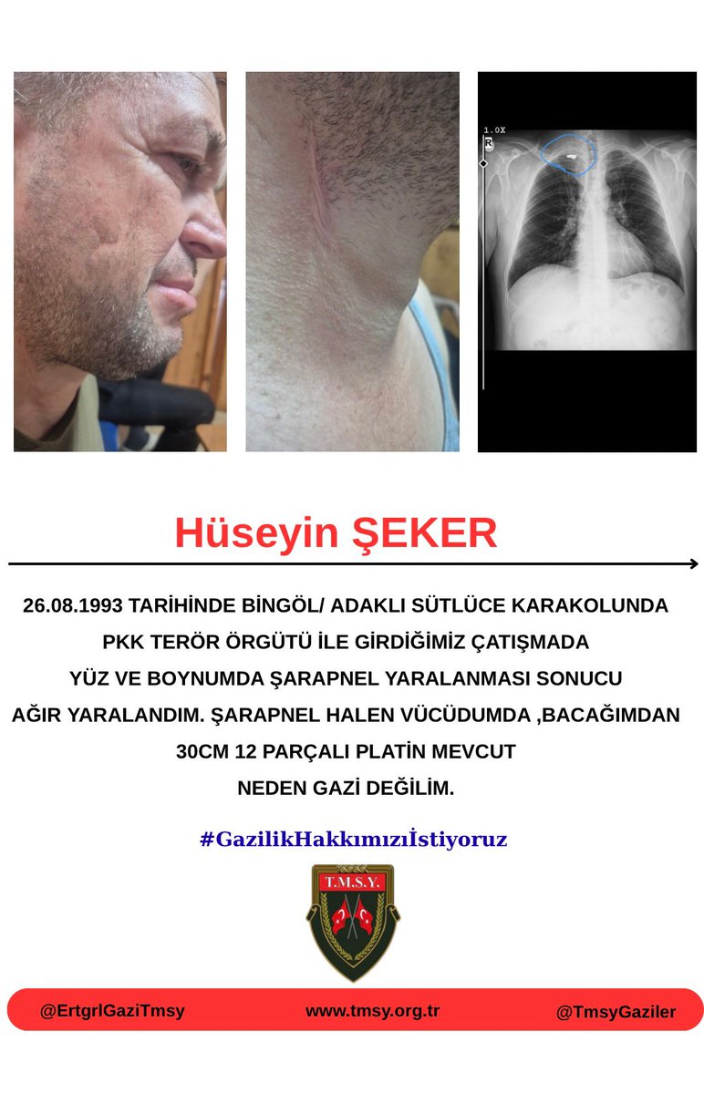 <a href="/ErtugrlGaziTmsy/">ERTUĞRUL GAZİ DEMİR</a> <a href="/TBMMresmi/">TBMM</a> <a href="/tcailesosyal/">T.C. Aile ve Sosyal Hizmetler Bakanlığı</a> <a href="/iyiparti/">İYİ Parti</a> <a href="/55erhanusta/">Dr. Erhan Usta</a> <a href="/TmsyGaziler/">T.M.S.Y GAZİ SAYILMAYANLAR</a> 🇹🇷BAYRAK🇹🇷
<a href="/TmsyGaziler/">T.M.S.Y GAZİ SAYILMAYANLAR</a> olarak  Devletimizin yanındayız..
<a href="/RTErdogan/">Recep Tayyip Erdoğan</a>
<a href="/_cevdetyilmaz/">Cevdet Yılmaz</a> 
<a href="/dbdevletbahceli/">Devlet Bahçeli</a>
<a href="/MahinurOzdemir/">Mahinur Özdemir Göktaş</a>
<a href="/drbetulsayan/">Dr.Betül Sayan Kaya 🇹🇷</a>
<a href="/celebimehmeta/">Mehmet Ali Çelebi</a> 
<a href="/sevansivacioglu/">Sevan Sıvacıoğlu</a>
<a href="/MvDrHasanArslan/">Dr. Hasan Arslan</a>
<a href="/ifarukaksu/">İsmail Faruk Aksu</a> 
<a href="/kocakkonuralp/">Konur Alp Koçak</a>
<a href="/leventalyyildiz/">Levent Ali YILDIZ</a>
<a href="/mhrmkurt/">Muharrem KURT</a>
<a href="/dtcuneytaldemir/">Dt. Cüneyt Aldemir 🇹🇷</a>