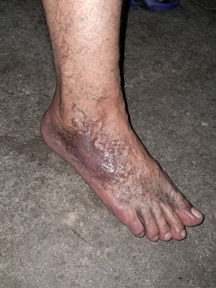 VenteJoven's tweet image. 🚨 URGENTE | José y Omario Castellanos, y su madre fueron trasladados a un lugar desconocido hoy en la madrugada. Desde entonces no se sabe nada de ellos.

⚠️ Omario padece insuficiencia venosa y necesita atención URGENTE.

Exigimos saber #DóndeEstánLosCastellanos y su liberación