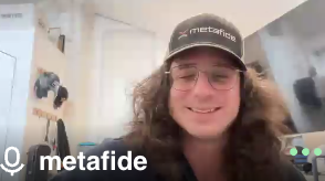 Fynn3ss's tweet photo. Dev Shaving Hair at 50m market cap!! 

BASED FUKIN DEV https://t.co/Wdn8Rgd8tZ