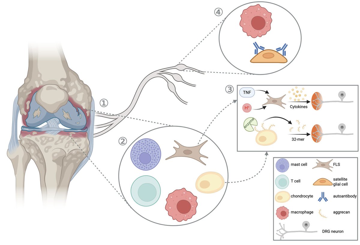 psalmotoxin's tweet image. With the annual @SfNtweets meeting coming up, I&apos;m looking forward to Saturday&apos;s symposium with @StuckyLab, @mike_doc_B &amp;amp; @Heegaardam: Not Just Neurons: Pain Is Orchestrated in Partnership with Many Non-neuronal Cells.

Here&apos;s our accompanying review!  
jneurosci.org/content/45/46/…