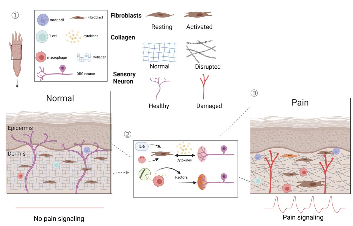psalmotoxin's tweet image. With the annual @SfNtweets meeting coming up, I&apos;m looking forward to Saturday&apos;s symposium with @StuckyLab, @mike_doc_B &amp;amp; @Heegaardam: Not Just Neurons: Pain Is Orchestrated in Partnership with Many Non-neuronal Cells.

Here&apos;s our accompanying review!  
jneurosci.org/content/45/46/…
