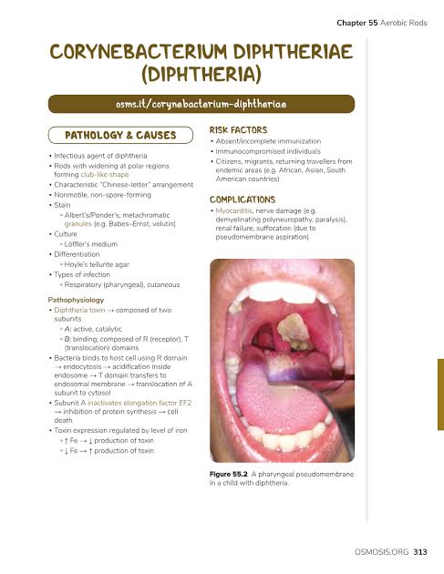 <a href="/drkeithsiau/">Keith Siau</a> A diphtheria is a symptom of a serious bacterial infection that can lead to a thick,gray membrane in the throat,making breathing &amp; swallowing difficult.severe cases involve formation of a "pseudo-membrane,"swollen neck glands("bull neck"),&amp; result in a high-pitched,barking cough.