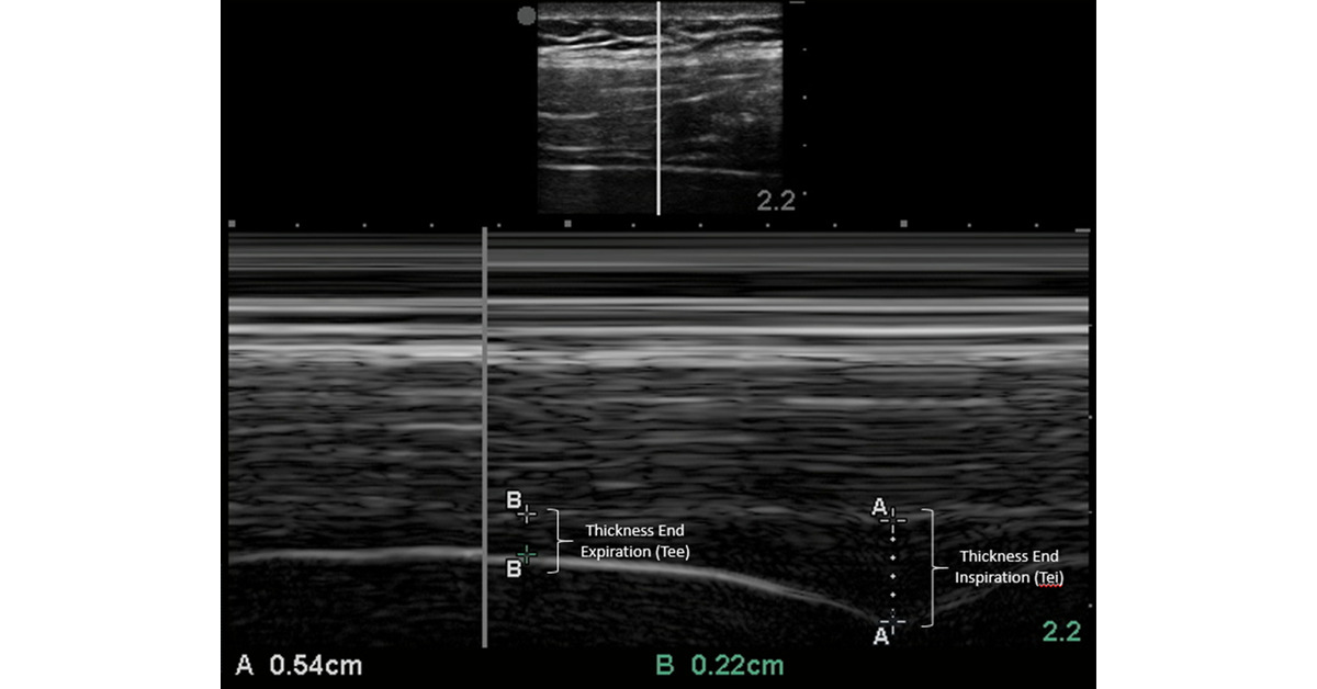Annals of the ATS tweet media