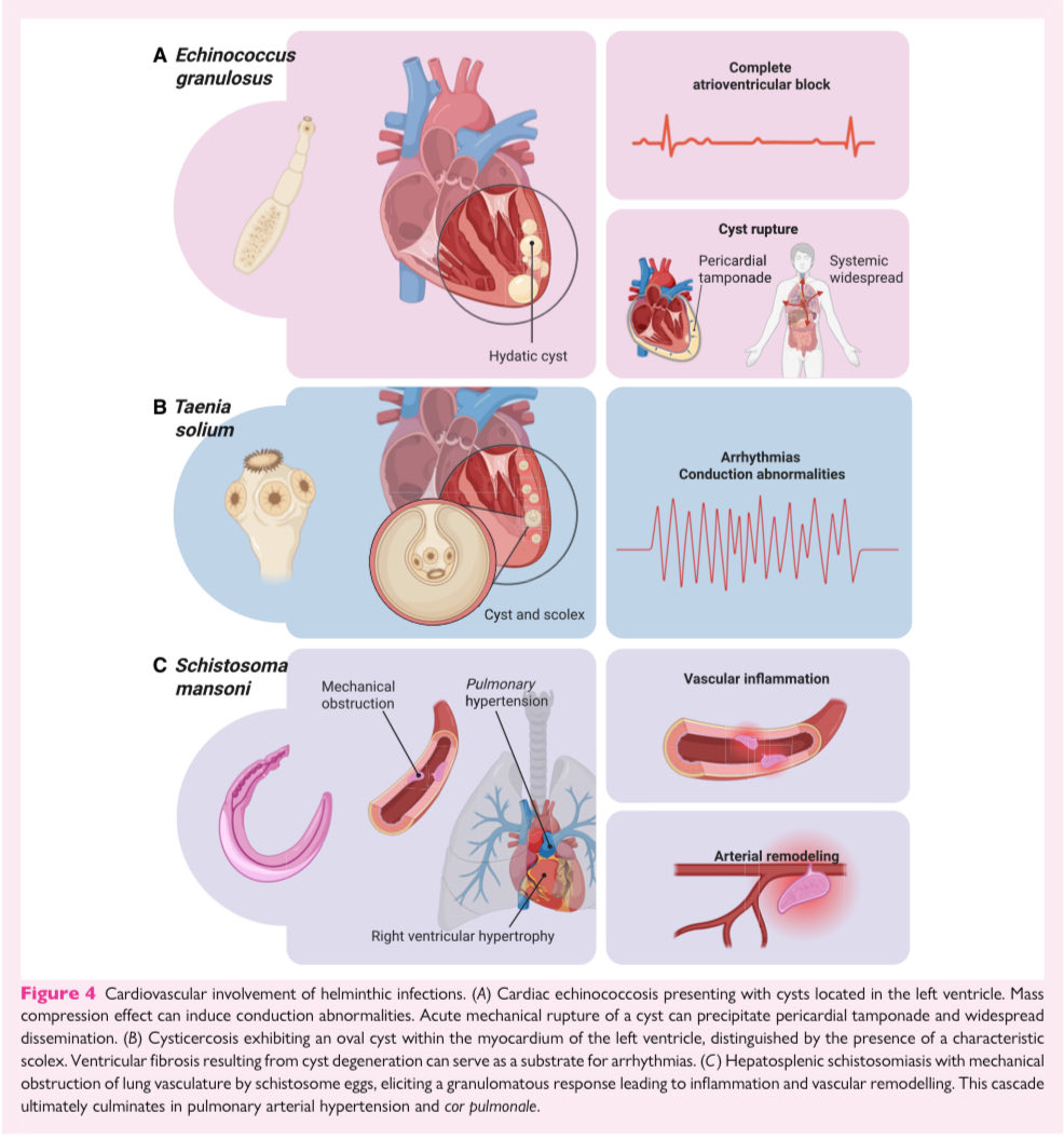 Ed_Alania's tweet image. 🗺️ Cardiac imaging in patients with tropical diseases: a scientific statement @ESC_Journals #Cardiology #CardioEd #echofirst #FOAMed