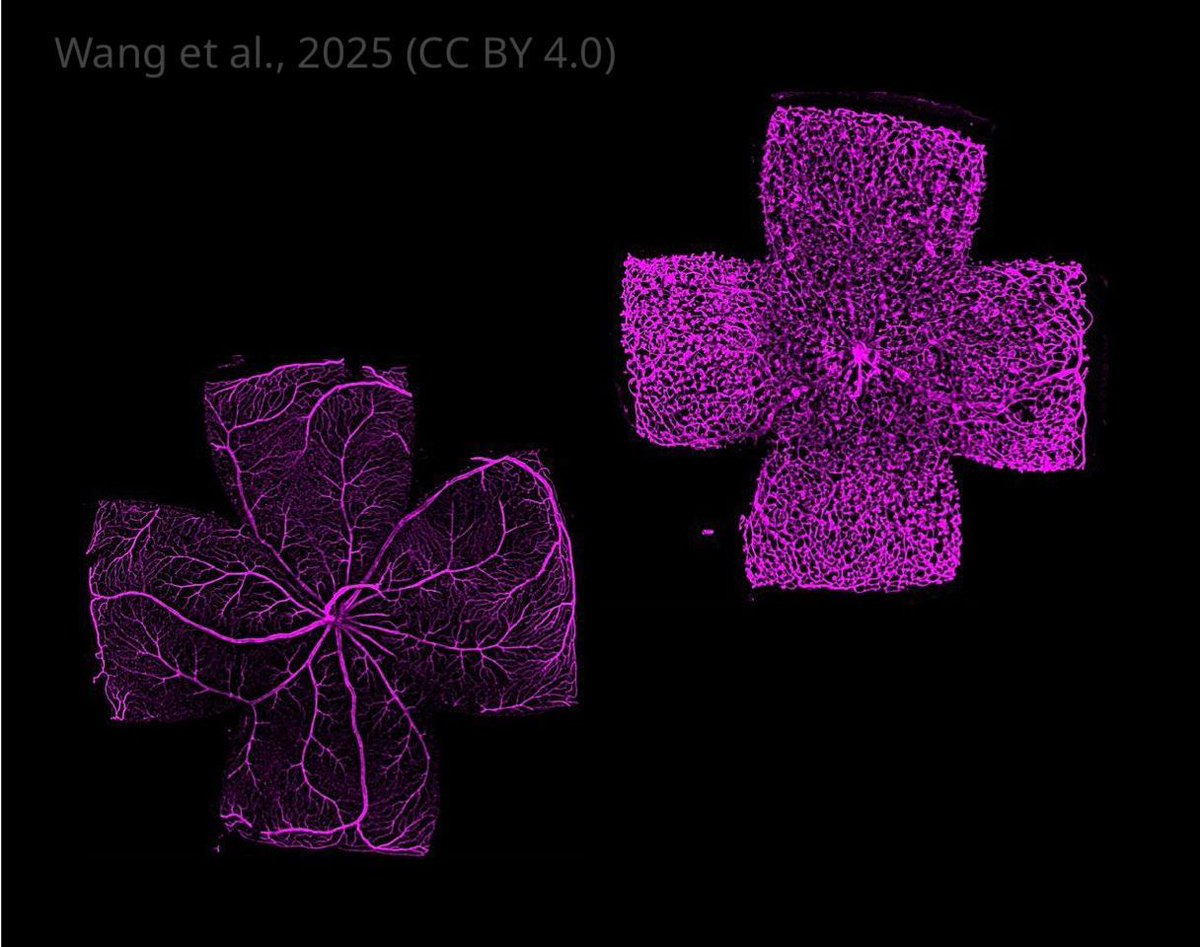 eLife's tweet photo. Findings reveal how TGF-beta signalling keeps the brain’s blood vessels healthy.

Disrupting this in brain blood vessels disrupts retinal development and triggers immune cell invasion, revealing its role in maintaining vascular–immune balance in the CNS.
https://t.co/dMfxykjKyB https://t.co/3LNSIL0iUi