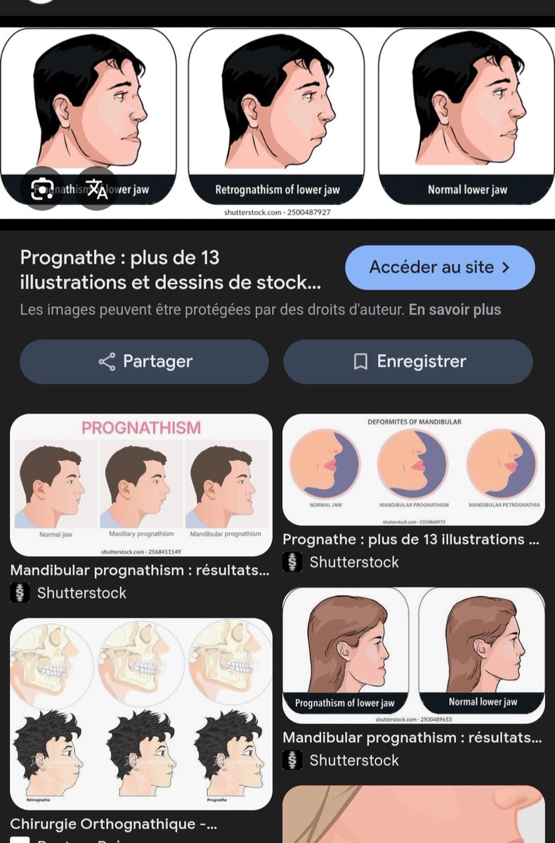 DulaJamel's tweet photo. @Qisaengg C'est juste une mâchoire définie gros, si elle avait un prognathe ses lèvres inférieures aurait été plus vers l'avant. https://t.co/SGwAyp1UaS