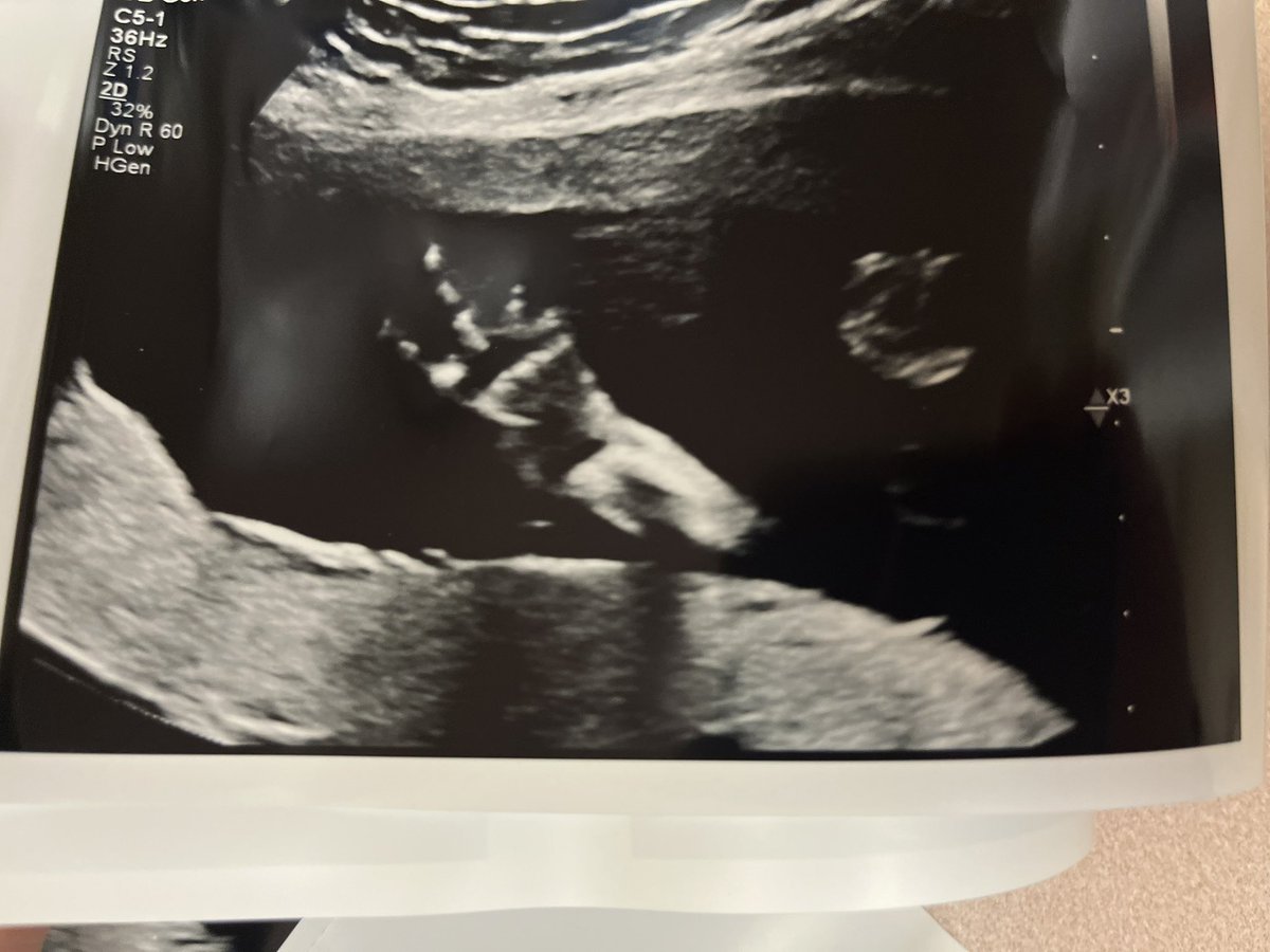 My son, chucking up a deuce