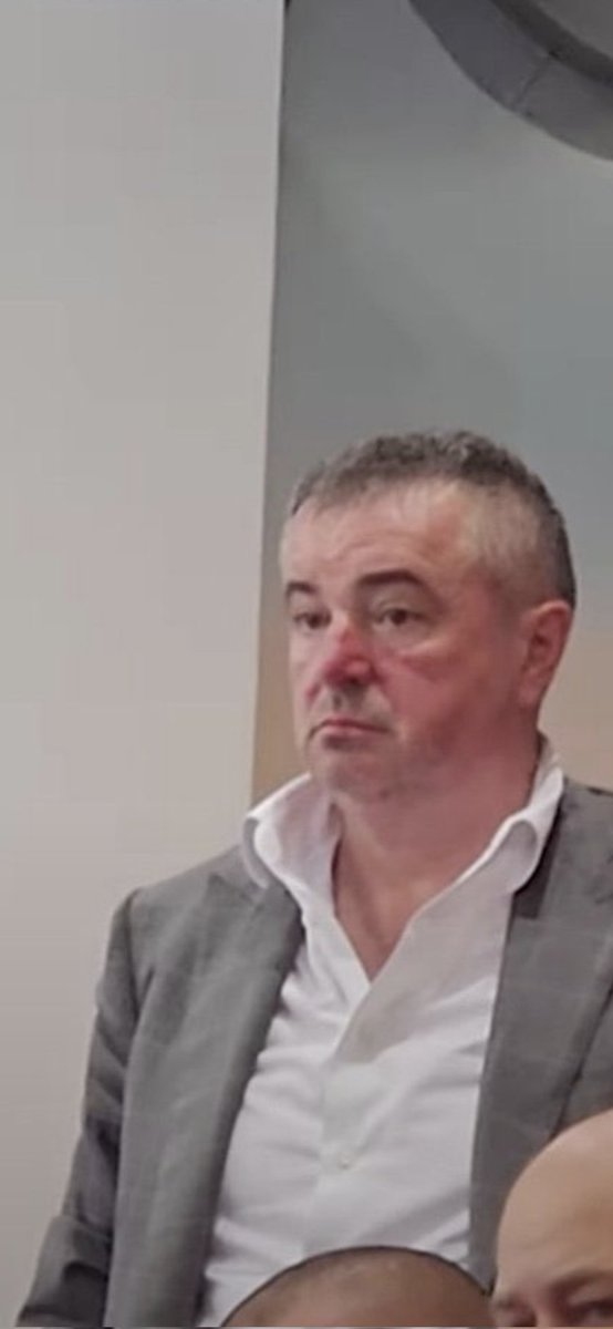 Proslavljeni reprezentativac Miroslav Beric se ponovo oglasio povodom sudjenja partizanu u EL. 
On ni trezan ne moze da veruje da su sudije dosudile 31 bacanje Monaku,a samo 16 za partizan!