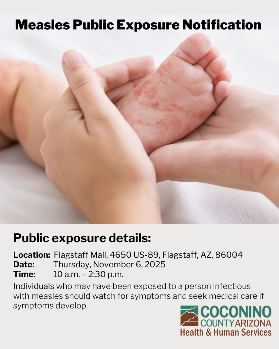 Coconino County has confirmed that a person with measles visited the Flagstaff Mall on Thursday, Nov. 6, 2025. This notification allows people who may have been exposed to watch for symptoms and seek medical care if symptoms develop. There have been no confirmed cases of measles