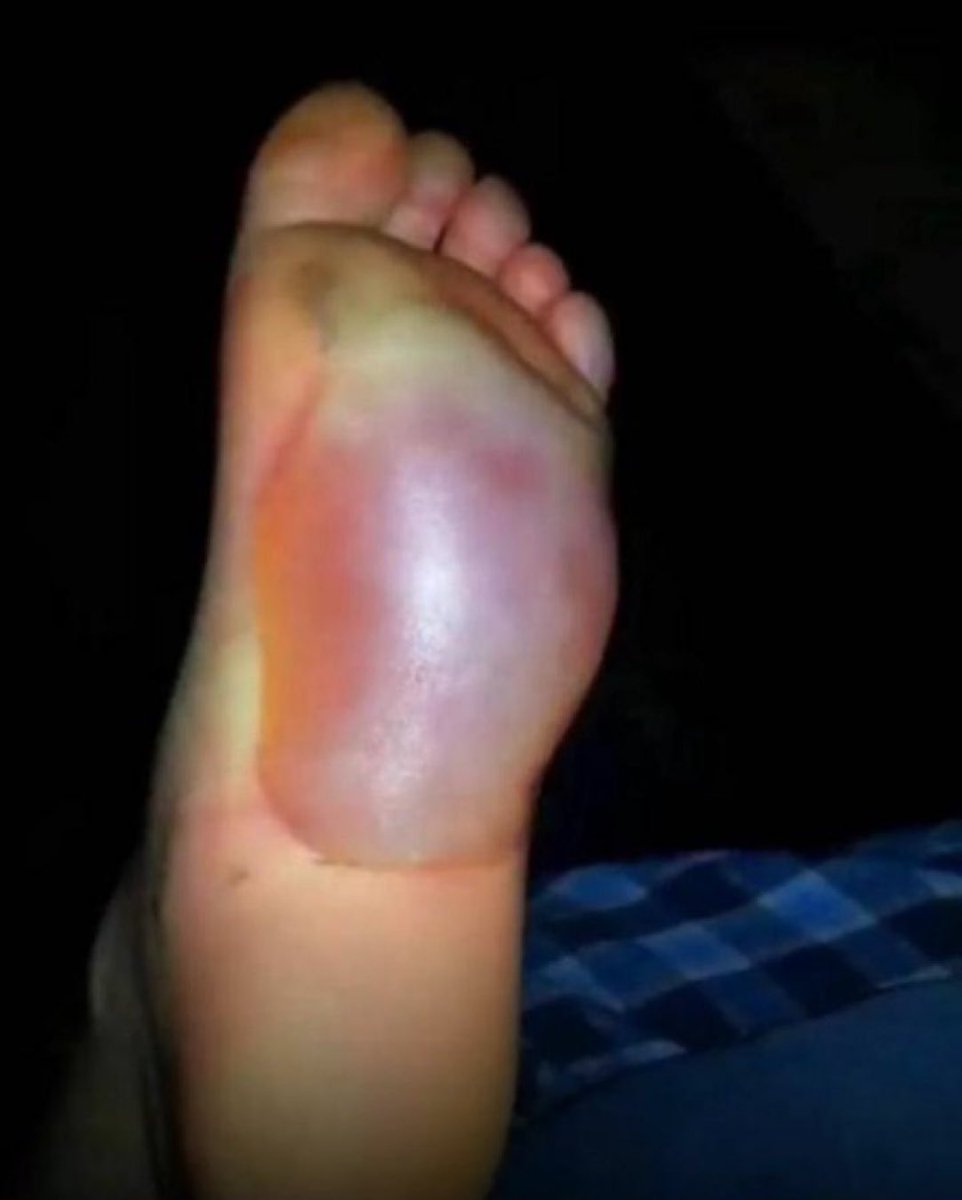 Don’t put yourself in my shoes😔