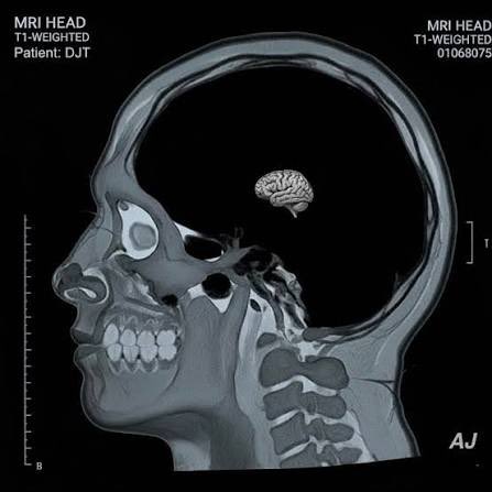 <a href="/atrupar/">Aaron Rupar</a> What the MRI showed - 😱😱😱