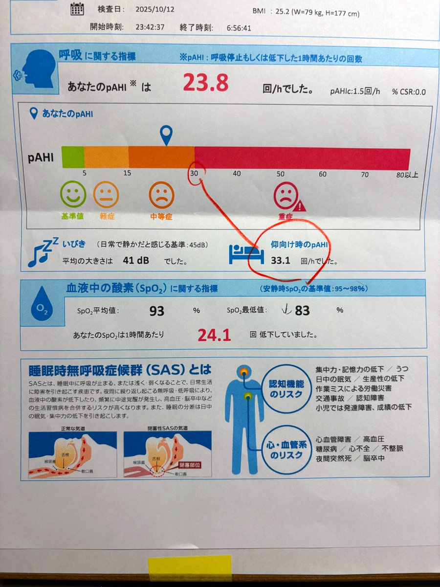 takayoshi50's tweet image. う～ん。割と重症(^▽^;) 最近は入院しなくても自宅で再検査できるらしい。ありがたや。
 #無呼吸外来 #CPAP