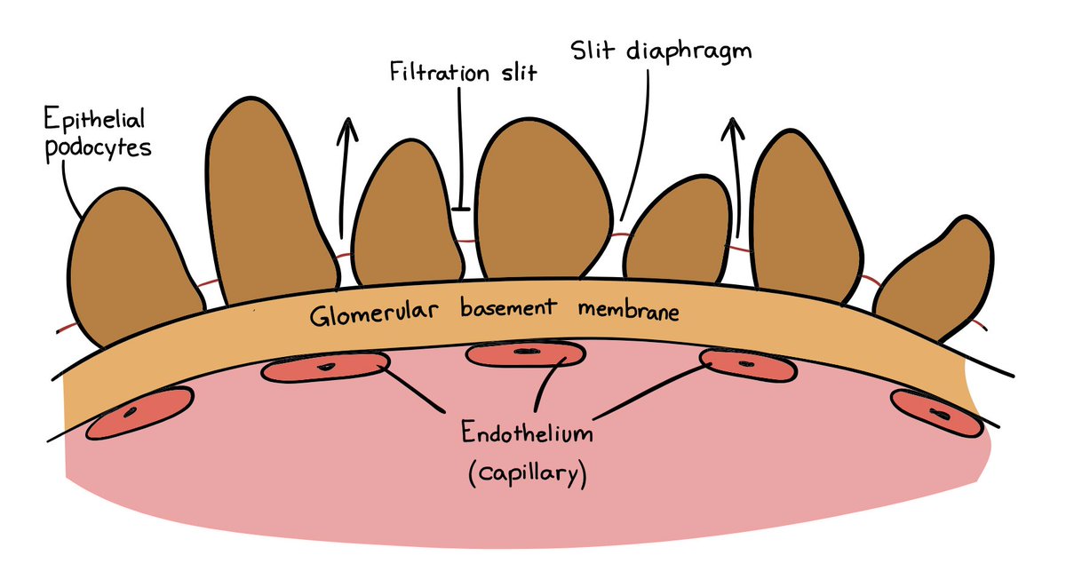 USMLEStepStudy's tweet image. Kidney GFR = 125 mL/min (180 L/day filtered)
~20% renal plasma flow is filtered
Filtration barrier: Fenestrated endothelium → basement membrane → podocyte foot processes
Charge selective: Neg charges repel albumin
Size: &amp;lt;7 kDa freely filtered; albumin (69 kDa) normally retained