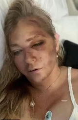 Virginia Giuffre is the most high-profile victim of Jeffrey ...