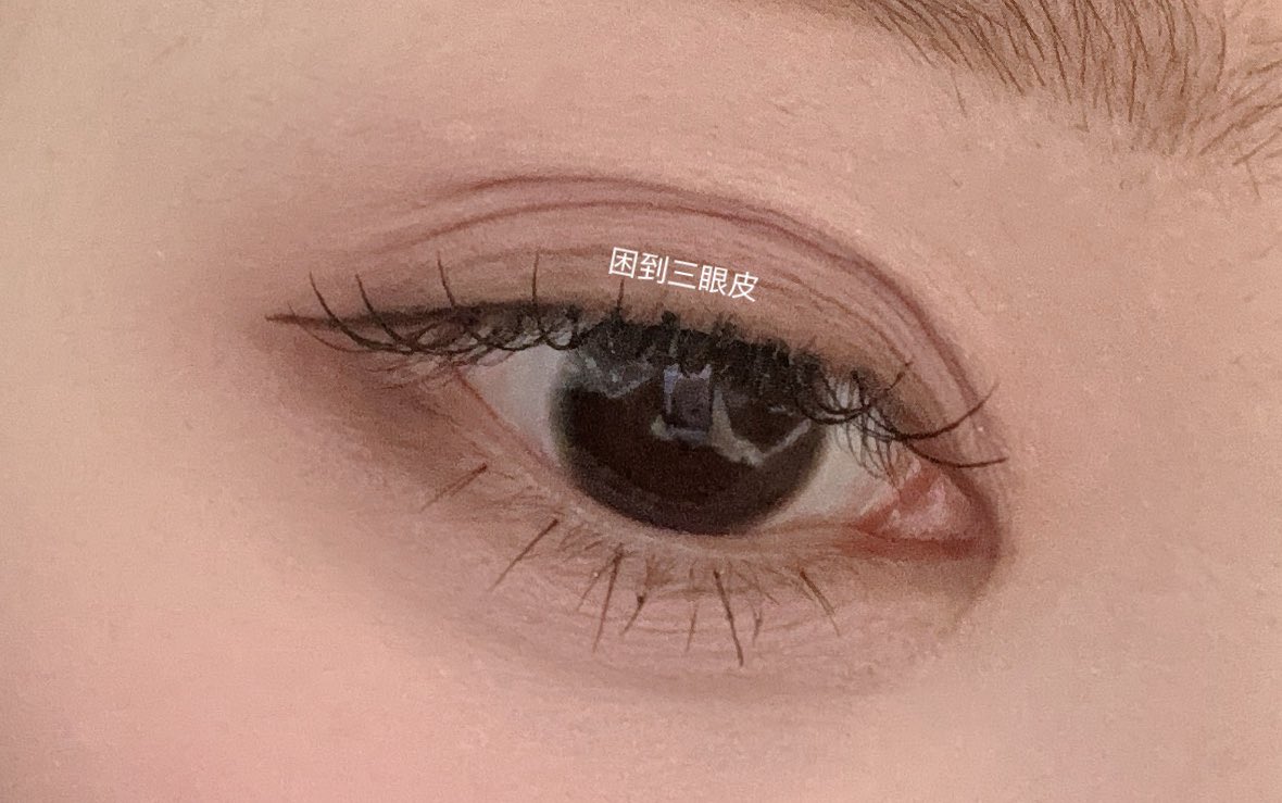 I missed the words on the eyelids “困(睏)到三眼皮”

“So sleepy that I have triple eyelids”
