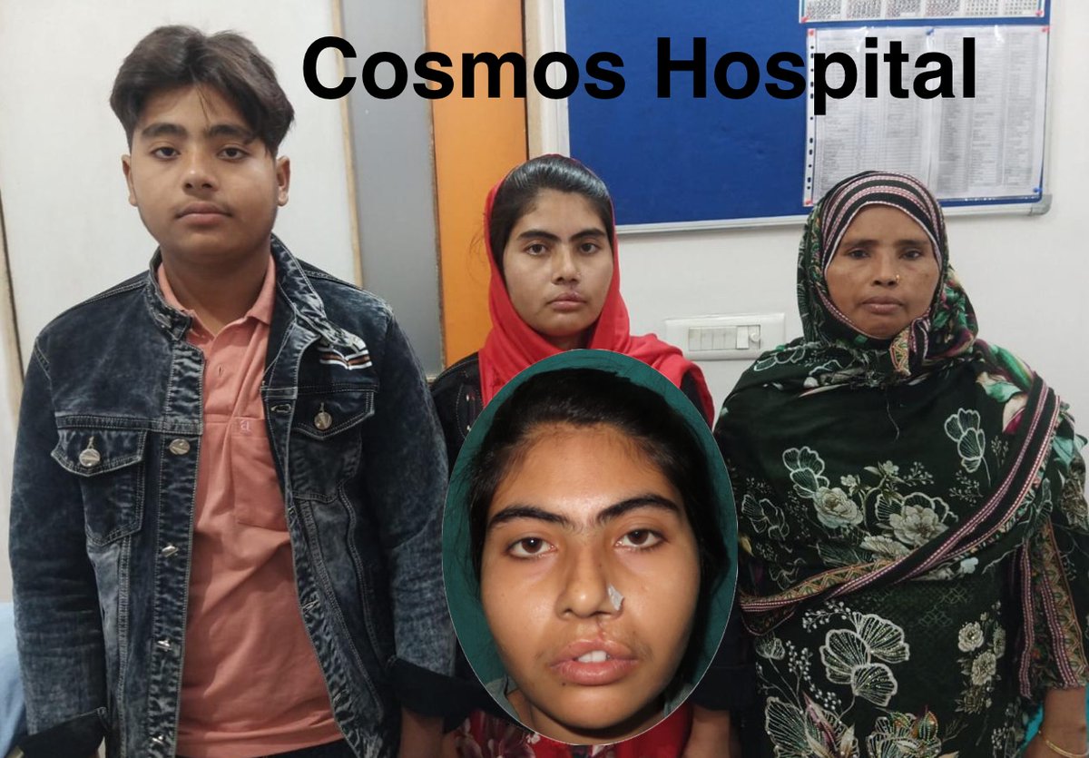 ANIRUDH_UP's tweet photo. Lip revision patient after suture removal..... #cleftlip #SmileTrainMoradabad ..... https://t.co/YHzpki85QN