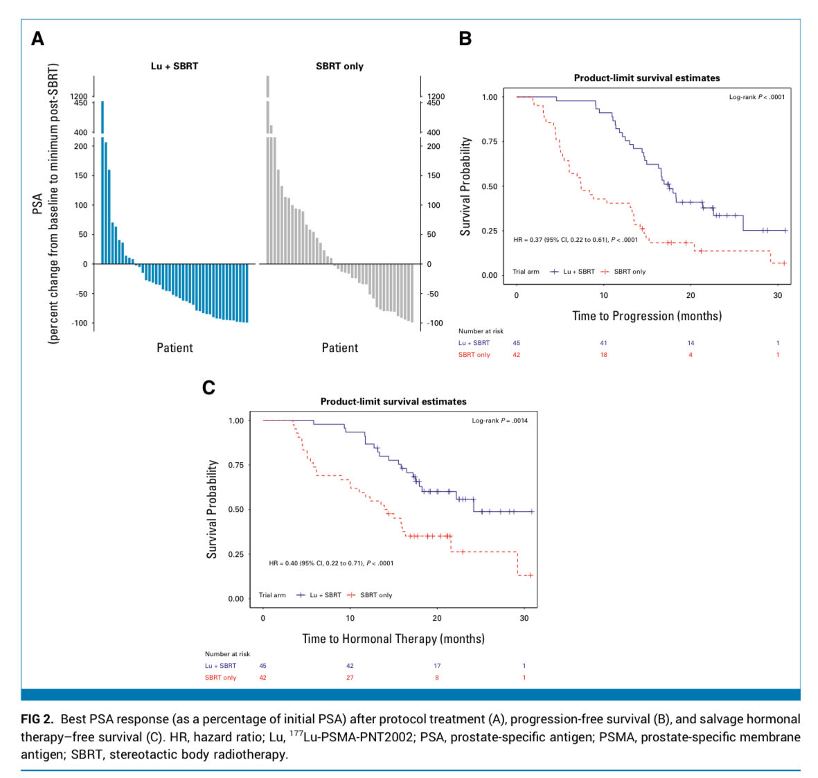 Adam_Weiner535's tweet image. 🚀 LUNAR phase II trial RCT of pts w/ oligorecurent hormone-sensitive #ProstateCancer 

🖊️ @JCO_ASCO 

🎯 Patients (n=92) randomized 1:1 to SBRT alone or ¹⁷⁷Lu-PNT2002 followed by SBRT

⭐️PFS doubled: 17.6 mo vs 7.4 months (HR 0.37, P&amp;lt;.0001)

📉 &amp;gt;50% PSA drops in 52% vs 31%

🧲…