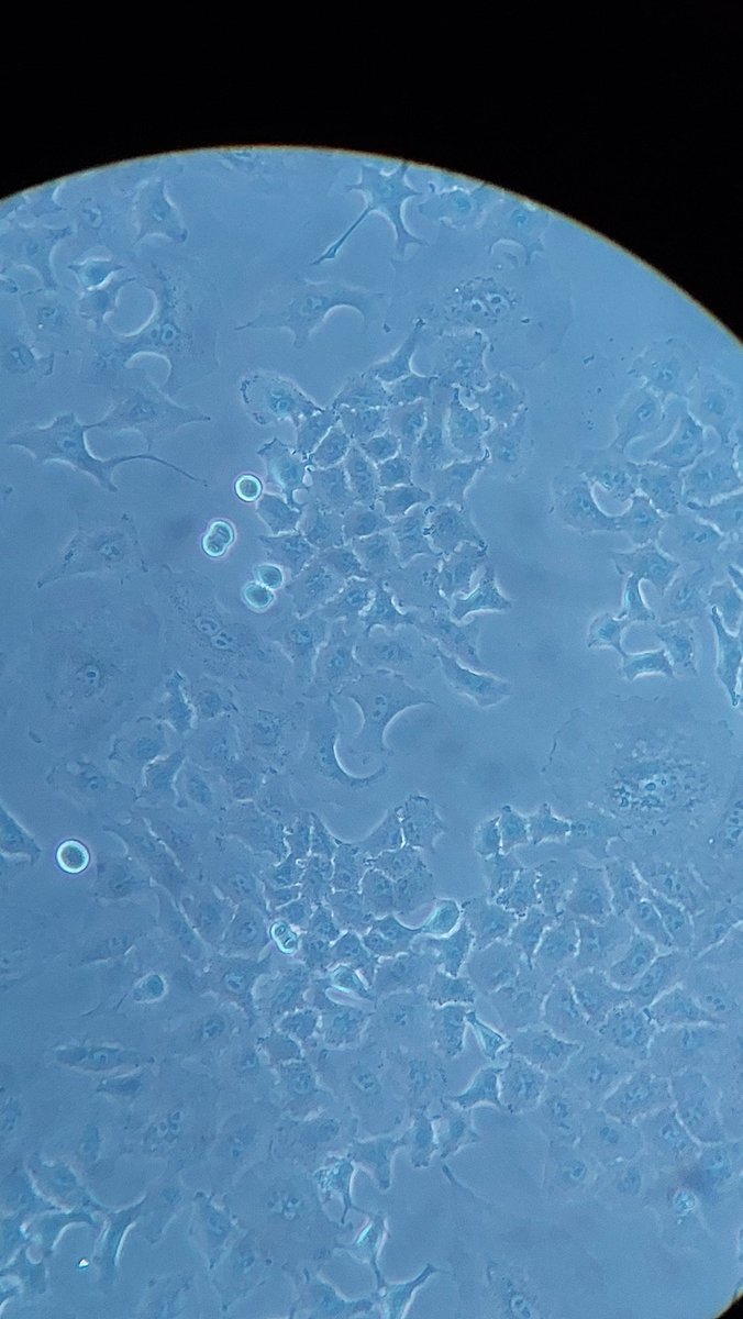I am currently growing A549 for the 3rd time and this is my second passage since I recovered a cryotube. This is the first time I encounter those dividing w/o but I am not sure what these are. Can you help me identify what is it? Your responses are appreciated.
