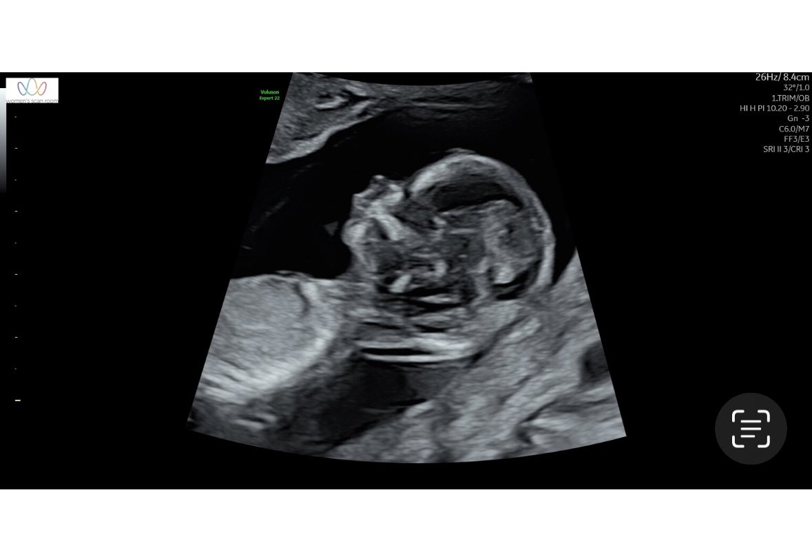 Miles Pfitzner tweet media