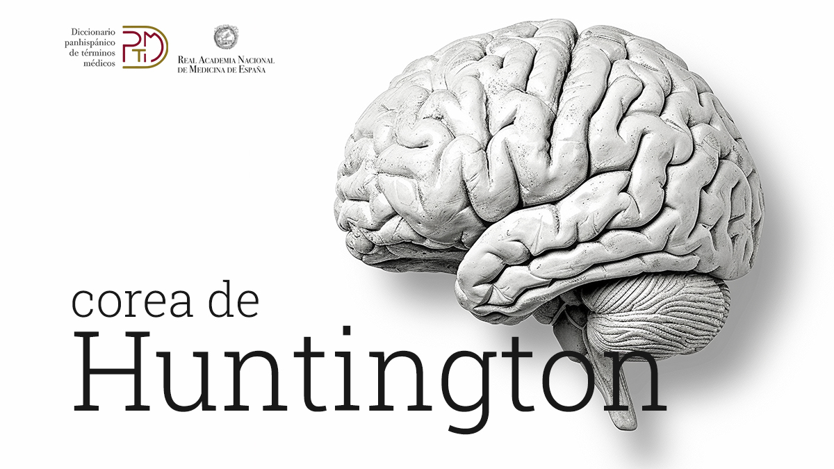 Esta enfermedad degenerativa del sistema nervioso central se caracteriza, entre otras manifestaciones, por un movimiento involuntario brusco, breve e irregular que se denomina «corea». #EnfermedadDeHuntington

Descubre más en el #DPTM: bit.ly/corea-huntingt…