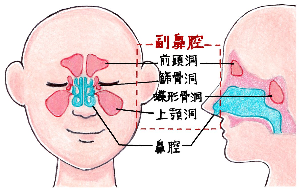 鼻水＝風邪？と思ったら副鼻腔炎だった⁉️ 「黄色や緑の鼻水が続く
