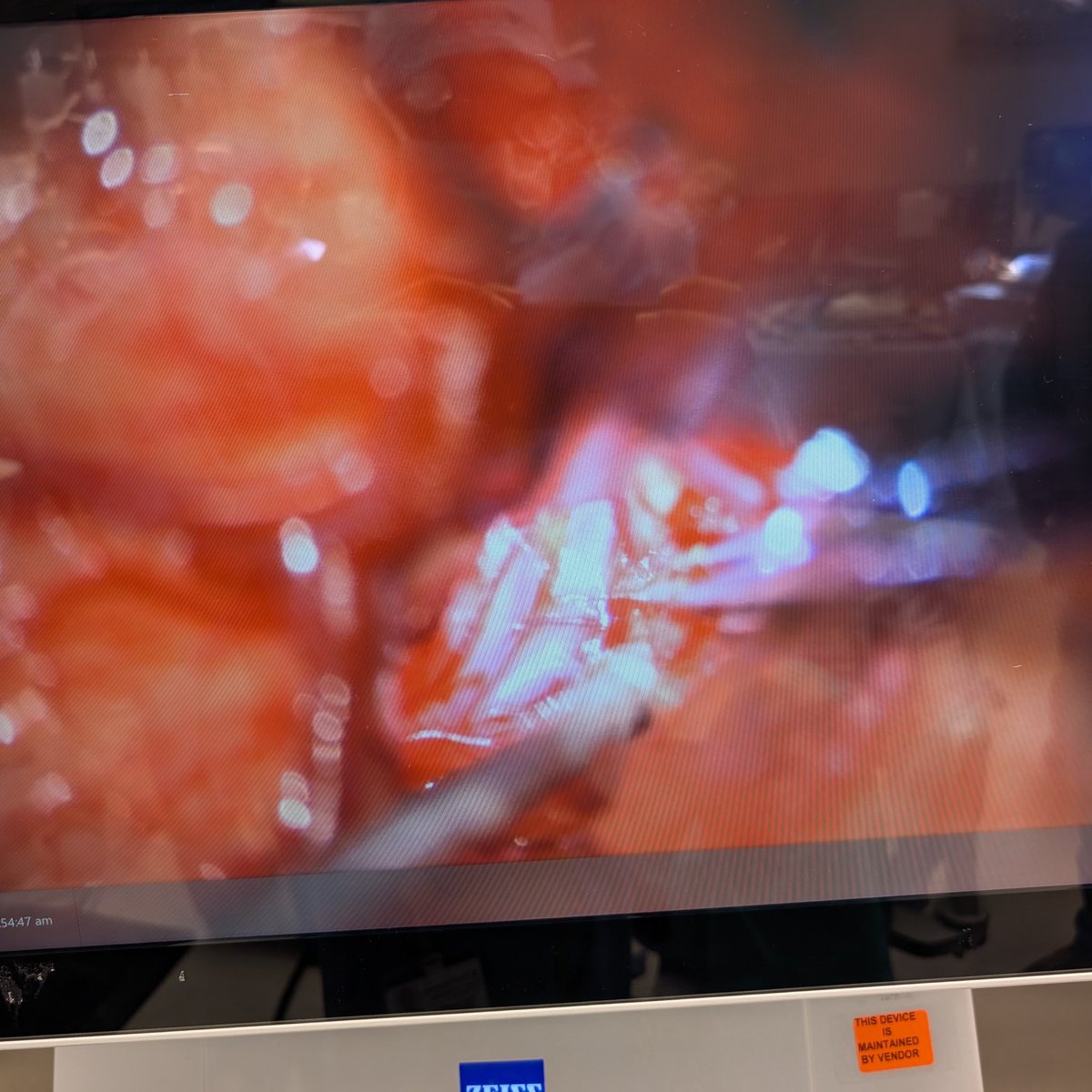 Visish M. Srinivasan, MD tweet media