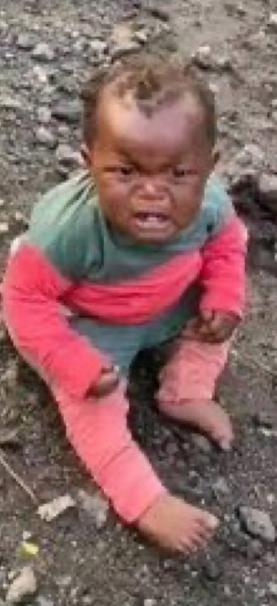 هذه الطفلة الوحيدة الناجيه من جميع أفراد أسرتها في الفاشر.. حَديثُك عنِّي قد يُنقذني 💔
#السودان: لا تمل الحديث عنهم وإن كنت وحدك.
#أنقذوا_الفاشر