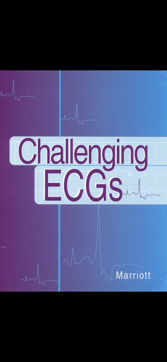 本日朝一の「レジェンドに学ぶ心電図のセッション」で三田村先生がご呈示された低カルシウム血症と高カリウム血症の心電図です🙇‍♂️何処かで見たことあるな〜🧐と思ったらこちらの書籍にありました🙇‍♂️「Tent on the desert」と呼ぶそうです🙇‍♂️砂漠のテント🏕️
#JHRS2025