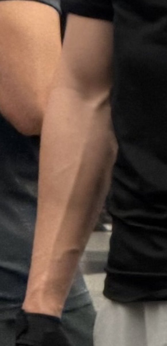 astonbun's tweet image. the vein 

#surfjava #javabh